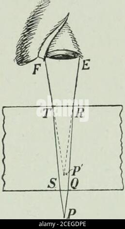 . Die Ontario High School Physik. 70. Brechung durch eine Platte. Eine Platte ist ein Teil des Amediums, der von zwei parallelen Ebenen begrenzt wird. In Abb. 368, PQRS zeigt den Verlauf eines Lichtstrahls durch eine Glasplatte. Es wird beim Betreten der Platte und wieder beim Auftauchen aus ihr wieder ausgefranstt. Da die Ungeheuerungen bei Q und R parallel sind, sind die Winkel, die mit diesen von QR gemacht werden, gleich. Jeder von ihnen ist r.dann, da die Winkel der Inzidenz und Brechung von den Lichtgeschwindigkeiten in den beiden Medien abhängen, und wenn wir das Licht entlang SR sendieren wird es durch den Kurs RQPit passieren ist offensichtlich, dass der Winkel zwischen SR an Stockfoto