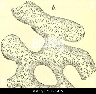 . Allgemeine chirurgische Pathologie und Therapeutik, in fünfzig Vorlesungen : ein Lehrbuch für Studenten und Ärzte. Stockfoto