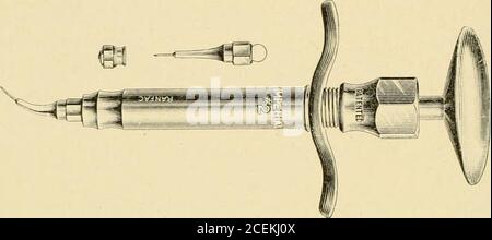 . Dental materia Medica, Therapeutika und verschreibungspflichtige Schreiben. ) e gelöst in einem der beiden normalen. Abb. 5. – Hypodermische Spritze. Kochsalzlösung* oder Ilingers Solution.f EIN 1 oder 2 Prozent, Lösung der Droge geeignet für alle zahnärztlichen Operationen. Auf dem Markt gibt es kleingestufte Porzellangeschirr mit Standard und Griff, in denen die Lösung zubereitet und, wo zulässig, über einem Bimsenbrenner oder einer Alkohollampe gekocht werden kann. Stockfoto