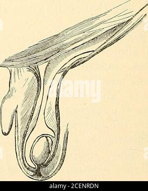 . Anatomie, deskriptiv und chirurgisch. [Abb. 653. Diagramme zur Darstellung der Herabkunft des Hodens und der Bildung der Tunica vaginalis (gezeichnet von J. T. Gray) – (Heide).] erscheint teilweise hohl, umgeben von einer Schicht gestreifter Muskelfasern, die auf diesen Körper aufsteigt, um an den Hoden befestigt zu werden. Nach Mr. Curling, das Gubemaculum sowie diese Muskelfasern teilt sich unten in drei Prozesse: Die [l Diese wichtige Arbeit ist in Outline im Brit veröffentlicht. Mittel Journ., 5., 12. Und 19,1887. März] ABSTIEG DER HODEN. 975 externer und breitester Prozess ist mit Pou verbunden Stockfoto