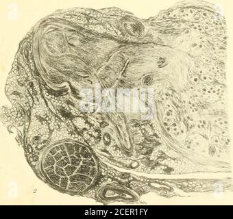 . Beiträge aus der Abteilung für Neurologie und dem Labor für Neuropathologie (Nachdrucke). Rhein Disease of the Radicular Ner/es Journal of Medical Research Vol. XXIII. Platte XIX. •;«i ^/^?fjj. Stockfoto