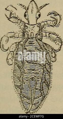 . Das fertige Handbuch der Erkrankungen der Haut. Sicher. Sie halten für ein paar Tage, und dann verschwinden von sich selbst. Um diese Stellen zu vergiverisieren, muss es eine Prädisposition auf dem Teil der Haut geben. Die meisten der wenigen gemeldeten Fälle waren unentschädigte SubjektInnen. Nach Duguet,1 werden die Makulen durch die Entleerung des Inhalts der Speicheldrüsen der Laus unter der menschlichen Epidermis erzeugt. Ätiologie. Diese verschiedenen Sorten von Pedikulose sind auf verschiedene Sorten von Läusen. Die Kopflaus (Abb. 43) ca. 2 mm lang und 1 mm breit, mit dreieckigem Kopf und breitem Thorax Stockfoto