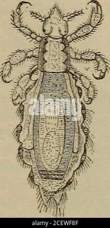 . Das fertige Handbuch der Erkrankungen der Haut. Pediculus capillitii. – Männlich. (Nach Kuchexheister.) Pediculus corporis.(nach Kuchexmeister. Abb. 45. Stockfoto