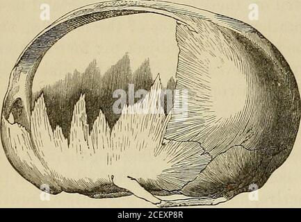 . Vorträge über chirurgische Pathologie : gehalten am Royal College of Surgeons of England. Wie der formative Prozess, gedanklich in Meerengen und DijSiculties geworfen, doch entspricht, sowohl in der Entwicklung Wachstum, mit dem Gesetz der Symmetrie. Es wäre noch interessanter, wenn wir sicherlich auf die Übereinstimmung mit dem Gesetz der Einheit des organischen Typs in der Form der Einfügung dieser WORMIAN-Zwischenknochen zurückführen könnten, wenn wir sie mit denen anderer Tiere vergleichen. Es kann nicht sicher getan werden; und dennoch, insome dieser Proben, dort erscheint (als ob in Übereinstimmung mit diesem Gesetz) eine Tendenz zum Stockfoto