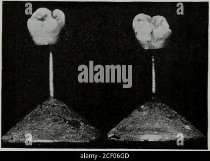 . Der Dental-Kosmos. Er wird in seine Fassung in die Platte eingesetzt. (5) EIN scharfer Spitzgraver (Abb. 93,d), verwendet in der Plattenarbeit für die Vertiefung des Loches, das durch den Marker gemacht wird. (6) EINE Länge des Drahtes – Draht mit Goldstift oder Draht aus Dental-Legierung. (7) EIN Topf mit Farbe, hergestellt durch Vermixen von Vermilion und Olivenöl. Zu viel Öl bildet eine Farbe, die nicht bereitwillig Anzeige-hier zu dem Teil, zu dem sie angewendet wird, während auf der anderen Seite zu viel ver-Milion die Farbe dick bildet, mit theresult, daß falsche Markierungen produziert werden.andere Pigmente wie Rouge haben vorgeschlagen, wie auch ein blauer Bleistift oder Buntstift, Aber im Großen und Ganzen wird Zinnober Stockfoto