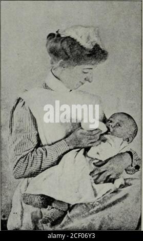 . The Dental cosmos. E, März 1914.) das Baby, und bevor die Milch aufgezehrt ist, wird dies durch das Gewicht des Armes erhöht, der die Flasche hält. Die Brust dagegen macht einen gewissen Widerstand gegen den ausgeübten Zug.Es war für mich von Interesse, diesen Punkt zu testen, und so hängte ich eine Pflegeflasche auf eine Federwaage und die Flaschenpost, die einem stillenden Baby gegeben wurde. Als der Säugling sich bemühte, seine Zelte zu leeren, gab es einen Zug von zwei Unzen, der bei jeder Saugbewegung ausging. Der Säugling, nach dem dieses versucht wurde, wasbreast-gefüttert für ungefähr sechs Monate, und die Flasche war vor kurzem r gewesen Stockfoto