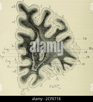 . Anatomie des Centers nerveux. De la Branche transversale de lincisure en H de Broca(fa). La substance grise sous-épendymaire (SGE), autour de laquelle viennentse grouper les faisceaux importants de cette coupé, affecte une forme irrégulière ;elle est située plus près de la face orbitaire du Lobe frontal que de ses facesexterne ou interne. Riche en vaisseaux, elle est traversée par un très Grand nombrede fibers à myéline, non réunies en fascicules, qui la sillonnent dans tous les senset qui appartiennent au faisceau occipito-fronlal (Voy. fig. L 295, S. Cette granderichesse en fibers lui donne su Stockfoto