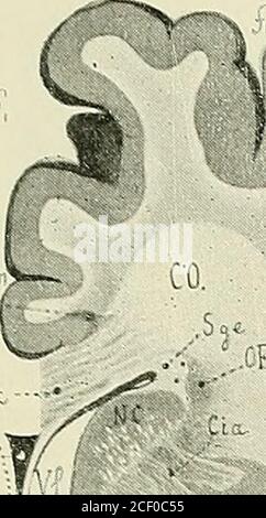 . Anatomie des Centers nerveux. De la convexité de lhémisphère, et une face inférieure que le sillonparallèle (t,), profond en général, sépare de la deuxième circonvolution Tempo-rale (T2). La face inférieure du lobe temporal est constituée par le lobule fusi-forme. (FUS) et la troisième circonvolution temporale (T3), limitée en dehors parledeuxième sillon temporal (t,) et en dedans par la Fusion du troisième sillon Tempo-ral et au sillon collatéral (ot+ ts). Sur les Coupés ns 63 und 66 (Abb. 245-246), lelobule fusiforme (Fus) est délimité par une incisure du sillon collatéral (of). Surla Coupé Stockfoto