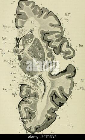 . Anatomie des Centers nerveux. De Graliolet (RTH) qui se portent dans la couche sagittale du lobeoccipital. SA face interne est bordée dune mince couche de fibers Blanches, lestratum zonale (Strz), qui se dédouble en avant et entoure le noyau antérieur (Na).Le noyau interne (Ni) se distingue par son Aspect homogène davec le noyauexterne (Ne), dans lequel pénètrent les fibers horizontales, radiaires, Du segmentpostérieur de la capsule interne (CIP) dune part, et le pédoncule antérieur de lacouche optique (path) ou Segment antérieur de la capsule interne (CIA) dautre part. Le Corps strié compre Stockfoto