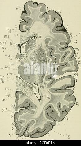 . Anatomie des Nervenzentren. Rées lune de lautre par la Partie infé-rieure de la circonvolution pariétale inférieure (P,). La première circonvolutiontemporale (T,) se continue en avant, avec lextrémité supérieure du pli temporalprofond (TP),très peu marqué sur cette coupé. En arrière de la deuxième circon-volution temporale (1%), la Partie verticale du sillon parallèle (t/) incise profon-dément lécorce cérébrale, et les deux circonvolutions qui le bordent constituentle pli courbe- (PC). La lèvre antérieure de ce sillon est formée par la circonvolu-tion pariétale inférieure (P,), la lèvre po Stockfoto