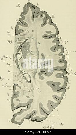 . Anatomie des Centers nerveux. De la capsule externe {CE), qui lui forment une bordure foncÃ©e et nette-ment dÃ©limitÃ©e ; en avant elle se perd insensiblement dans la Masse des fibersdAssociation du lobe frontal, tandis quen arriÃ¨re, elle se prolonge dans la couchesagittale du lobe occipital quelle concourt Ã former. Sur cette coupé, enfin, legenou de la capsule interne (CI[g]) commence Ã se dessiner. Entre la capsuleexterne (CE) et lÃ©corce qui limite le sillon marginal supÃ©rieur de linsula (ms), ontrouve une lame blanche, formÃ©e par les fibers du faisceau arquÃ© ou longitudinalsupÃ©rieu Stockfoto