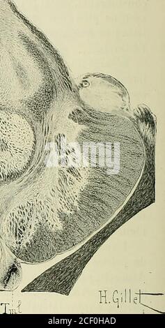 . Anatomie des Centers nerveux. ; JTUJ j Te 1U ,T ï : lu. ?sa* un Fie 193. – Coupe transversale de la Partie supérieure du pédoncule cérébral delliommeau Niveau de la bandelette optique, intéressant les tubercules quadrijumeaux an-térieurs, le Corps genouillé interne, les noyaux roues, le noyau de la troisième paire,le tubercule mamilaire médian et le latélle. (Méthode de Wei-gert. Agrandissement 2 i/2diamètres.lDétailsdessinés à un grossissement de 12diam. ARJ, aqueduc de Sylvius. –? Brqp, bras du tubercule quadrijumeau postérieur. – CNR, Cap-sule du noyau Rouge. – CGI, c Stockfoto