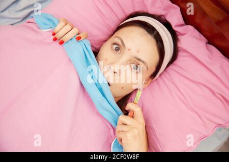 Portrait junge Frau mit Windpocken im Bett liegen und messen Temperatur Stockfoto