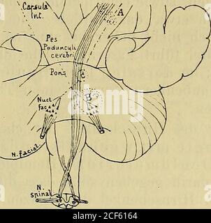 . Diagnostik der Krankheiten des Nervensystems : eine Anleitung zur Untersuchung Nervenkranker. NthaltEasern, welche vom Kleinhirn zum rothen Haubenkern ablaufen.Diese haben sicherlich Beziehungen zum Muskelsinn und zur Gleichgewichtserhaltung. Herde einer Brückenhälfte im mittleren oder unteren Drittelder Brücke setzen eine Lähmung der entgegengesetzt liegenden Extremitäten und des dort liegenden Facialis und war in allen seinen Zweigen, also entspricht der peripheren Facialis-Lähmung(hemipleical Gustans inferior, gje Hemselmund). Dies kommt dah Stockfoto