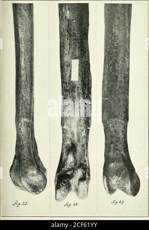 . Transaktionen. SHUFELDT: FOSSIL BIRDS IX MARSH COLLECTION OF YALE UNIVERSITY PLATE IV [Alle drei Figuren auf dieser Platte wurden mehr als ein fünfzehntes verkleinert] Abb. 25. Innerer Aspekt des etwa distalen Zweidrittel des rechten Tibio-tarsus vonHesperornis regalis Marsh. (Gipsabguss vom Typ Knochen.) Vergleichen Sie mit Figureson Plate III. (Nein 56 der paläontologischen Sammlung (Vogelabteilung) der U-. S.Nat. Mus.) Abb. 26. Das gleiche Exemplar wie in Abbildung 25 gezeigt und auf dessen Anterioraspekt betrachtet. Abb. 27. Das gleiche Exemplar wie in den Abbildungen 25 und 26 dieser Platte und Viewedupon i dargestellt Stockfoto