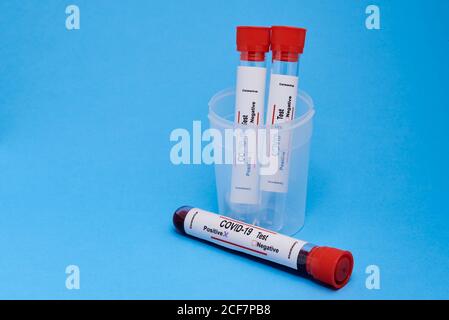 Von oben Nahaufnahme der Reagenzgläser mit Blutproben in Kunststoffbecher für Coronavirus-Diagnosetest mit positiver Markierung platziert Auf blauem Hintergrund Stockfoto