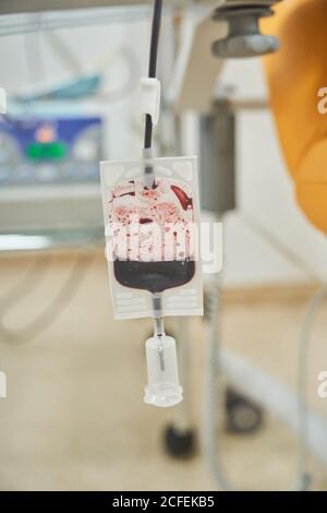 Plastiktüte mit Spenderblut während des Verfahrens der Transfusion in Modernes medizinisches Labor Stockfoto