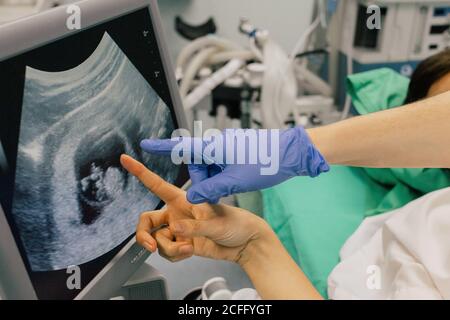 Crop unkenntlich Arzt in blauen Handschuh zeigt mit Zeigefinger Auf dem Computerbildschirm, während der anonyme Fetus des Patienten während der Ultraschalluntersuchung angezeigt wird Test in der Klinik Stockfoto
