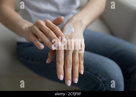 Nahaufnahme junge Frau Anwendung feuchtigkeitsspendenden Balsam auf die Hände. Stockfoto