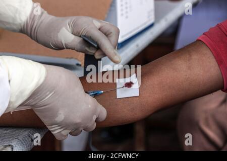 Lhokseumawe, Indonesien. September 2020. Ein Polizist, der einen ethnischen Rohingya-Flüchtling in einem provisorischen Unterschlupf untersucht, nimmt Blut in einem Schutzanzug (PSA).Fast 300 ethnische Rohingya-Muslime sind in den Gewässern des Aceh-Meeres gestrandet. Bestehend aus Erwachsenen und Kindern, die aufgrund von Austrocknung und Hunger schwach sind, nachdem sie auf hoher See beeinflusst wurden. Kredit: SOPA Images Limited/Alamy Live Nachrichten Stockfoto