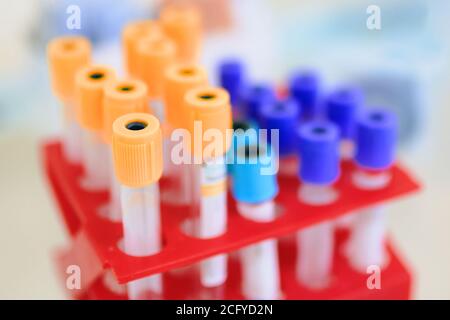 Laborröhrchen im Boxcontainer im Forschungslabor. Blutröhrentest zur Analyse im Labor für Hämatologie oder Krebs. Stockfoto