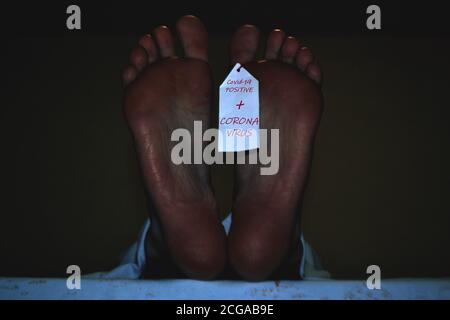 Fuß der toten Person, die mit Covid-19 und infiziert wurde Aufkleber mit positiven Testergebnissen Stockfoto