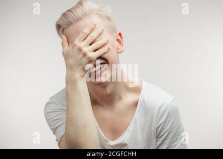 Emotional überglücklich Albino männliche Modell greift sein Gesicht aus Lachen , kann nicht anders als zu lachen. Hipster Kerl grinsend mit fröhlichen Blick. Positive EMO Stockfoto