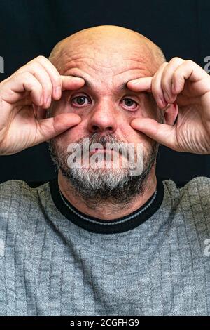 Kahler, bärtiger Mann mittleren Alters grimaces mit seinen Fingern auseinander auf einem dunklen Hintergrund Stockfoto