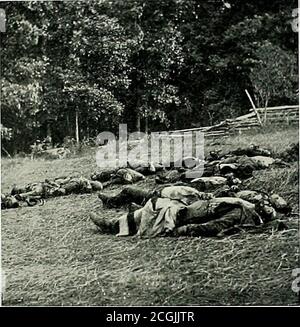 . Originalaufnahmen auf den Schlachtfeldern während des Bürgerkrieges der Vereinigten Staaten. CHIRURGEN, DIE VERWUNDETEN VERABREICHEN. LEBEN FÜR IHR LAND GEOPFERT Stockfoto