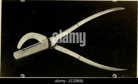 . Tierkastration, ein Buch für die Verwendung von Studenten und Praktikern; . Abb. 78 – Halten des Schweins für die Kastration. Abb. 79 – Halten Schwein für Kastration. Konstruiert für Kastrieren Schweine und Schafe, und ist etwa ein-halb so groß wie die bei der Kastrierung Hengste und Hengste und etwa doppelt so groß wie die Hunde-und Katzeninstrument verwendet. .! Natomie – das Hodensack besteht aus zwei Beuteln, die aus hautsubkutanem Bindegewebe usw. gebildet werden.Diese Beutel sind durch eine Raphe- oder Medianlinie unterteilt und passen in die Nähe der perinealen Re-Region. Diese Beutel enthalten jeweils einen Hoden (Abb. 81) die entschieden kürzer und Mo Stockfoto