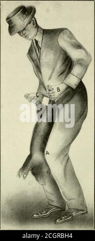 . Tierkastration, ein Buch für die Verwendung von Studenten und Praktikern; . Abb. 78 – Halten des Schweins für die Kastration. Abb. 79 – Halten Schwein für Kastration. Konstruiert für Kastrieren Schweine und Schafe, und ist etwa ein-halb so groß wie die bei der Kastrierung Hengste und Hengste und etwa doppelt so groß wie die Hunde-und Katzeninstrument verwendet. .! Natomie – das Hodensack besteht aus zwei Beuteln, die aus hautsubkutanem Bindegewebe usw. gebildet werden.Diese Beutel sind durch eine Raphe- oder Medianlinie unterteilt und passen in die Nähe der perinealen Re-Region. Diese Beutel enthalten jeweils einen Hoden (Abb. 81) die entschieden kürzer und Mo Stockfoto