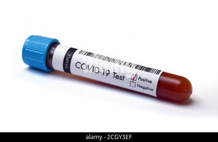 Teströhrchen mit Coronavirus-Testblutprobe positives Ergebnis auf Weiß Hintergrund Stockfoto