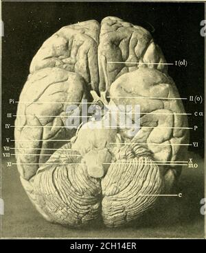 . Eisenbahn und andere Unfälle im Zusammenhang mit Verletzungen und Erkrankungen des Nervensystems : ein Buch für den Einsatz vor Gericht . Abb. ist. - rechts Homon^-mous hemianopsia. (Purves-Stewart.) Flecken, die mit schillernden Farben gesäumt sind. Sie dauern eine Zeit lang an und verschwinden in Richtung der Peripherie des Gesichtsfeldes. Der Okulomotoriis oder der Nervus t/m^d betrifft die Reflexbewegungen der Iris, die innere Vation des Levator palpebrarum sowie alle Muskulatur des Augapfels, mit Ausnahme des oberen schrägen, der durch den Patheticus oder den vierten Nerv und den äußeren Rectus betreut wird, Stockfoto