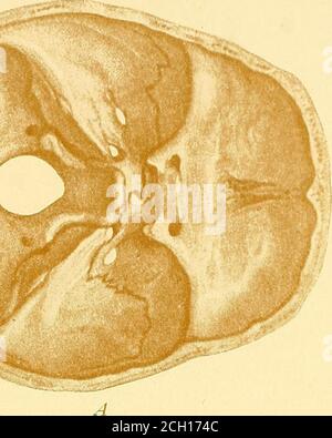 . Eisenbahn und andere Unfälle im Zusammenhang mit Verletzungen und Erkrankungen des Nervensystems : ein Buch für den Einsatz vor Gericht . Zx Stockfoto