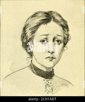 . Eisenbahn und andere Unfälle im Zusammenhang mit Verletzungen und Erkrankungen des Nervensystems : ein Buch für den Gerichtgebrauch . oder ein Pickel, oder etwas gleichfalls trifling Sache, die angeblich eine neue Entwicklung sein.Diese Symptome sind hoch charakteristisch für die Hypo-Chondriakal-Typ. Während die Aufmerksamkeitskraft sowohl bei traumatischen als auch bei anderen Formen der Neurasthenie direkt geschwächt wird, bleibt das Gedächtnis in der Regel unberührt, was bei Hysterie aber nicht der Fall ist. (Siehe traumatische Unheiligkeit.) ^^ Verblendungen des Neurasthenic ist am auffälligsten; infact kann es in obstinate und protractedcases als somethin betrachtet werden Stockfoto