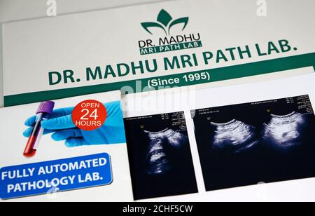 Ultraschall-Scan-Bericht Stockfoto