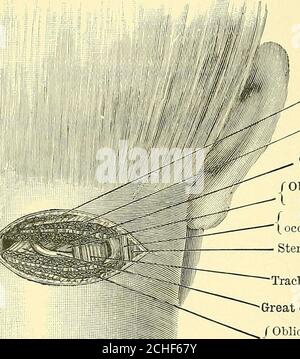 . Textbuch der operativen Chirurgie . Trapez.Splenius capitisComplexus. f obliquus(  capitis inf. / klein(, Okzipital n. Sterno-Mastoid. Traclielo-mastoid.Great occipital Il r obliquus capitist sup. Abb. 116.- -Ligatur der Arteria occipitalis aud Exposition des kleinen Nervus occipitalis.großer Nervus occipitalis. Nach dem Teilen der Aufsätze des Levator anguli scapula? Zu den Transverseprozessen (und dem Vorziehen des Muskels) sehen wir den kurzen starken Bauch des Theobliquus capitis inferior, um dessen äußeren Rand sich der große Hinterhauptnervenaufhänger befindet. Dem Nerv folgend finden wir seinen Ausgang A Stockfoto