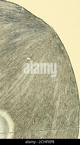 . Text-Buch der operativen Chirurgie . unmittelbar über Stensons Ductus,beinhaltet die ernste Gefahr der Verletzung der Ramus maximus des Gesichtsnervs. Präferenz muss Bockenheimers Einschnitt gegeben werden, Die Länge beträgt 4 cm und erstreckt sich vom Mundwinkel bis zur Incisura intertragica, die Mitte wird über dem vorderen Rand des Masseters platziert. Nachdem die päd Fett in den Käkis ausgesetzt, wird der Nerv gefunden liegen auf der äußeren Oberfläche des Bukzinatormuskels. Es kann notwendig sein, um die Fasern des Muskels zu Spalten und erreichen das Nerveat die innere Oberfläche des coronoid-Prozess. 228 OPERA Stockfoto