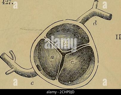 . Quains Elemente der Anatomie . Abb. 427. – die Halbunarklappen befinden sich auf der AORTA- und Puljionart-Arterie, seenFROM TUEiR DISTALE SEITE (Allen Thomson). I, transversaler Abschnitt der Pulmonalarterie unmittelbar über der Befestigung der thosemilunaren Klappen: A, der linke und c, die rechten vorderen Segmente; h, das hintere Segment:gegenüber jedem der Sinus von Valsalva ist zu sehen, und die Befestigung der Klappensegmente an der inneren Wand der Arterie. II, ein ähnlicher Abschnitt der Aorta: A, das linke hintere Segment, h, das vordere Segment, mit den entsprechenden Nasennebenhöhlen von Valsalva, aus dem das Koronar ar Stockfoto