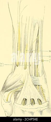 . Textbuch der operativen Chirurgie . X. communicans fibularis. ROrt der Injektion von- sural bracli von (^ ext. Popliteal n. Ext. Saphena n. Abb. 11. – Konduktion aiisestliesie (Braun) für Beinrückseite (nach Spalteholz). OPERATIVE CHIRURGIE Wir stimmen Halsted und Schleich zu, dass der Lingualnerv unempfindlich durch eine snbmucose Injektion an der Stelle, an der die vordere Säule der Diebstähle den Mundboden verbindet, rendered werden kann. Der Punkt, an dem das untere Zahnnerv in den Knochen eintritt, wird durch die lingula auf der inneren Seitenfläche des Theramus des Kiefers angezeigt. Für die Extraktion von Zähnen, Stockfoto