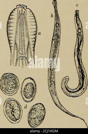 . Ein Handbuch der klinischen Diagnose mittels mikroskopischer und chemischer Methoden, für Studenten, Krankenhausärzte und Praktiker. Ascaris mystax. (v. Jaksch.)a, männlich; b, weiblich ; c, Kopf ; d, Ei. Oxyuris vermicularis. (v. Jaksch.)a, Kopf; b, männlich; c, weiblich; d, Eier. Drei lippenartige Projektionen mit seitlichen Gelenkverdickungen können befallen. Der Schwanz des Männchens ist mit sechs Paaren von Papilla versehen?, und Feige. 61. Stockfoto