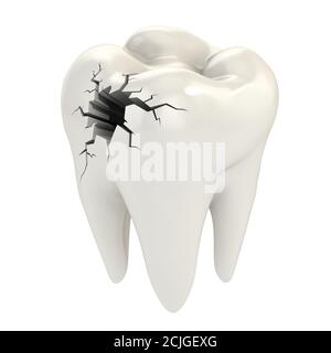 Zahnschmerzen, gebrochener Zahn 3d-Konzept Stockfoto
