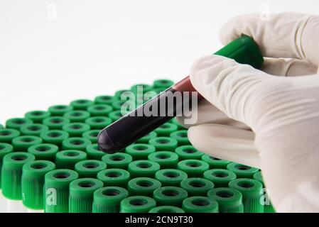 Vacutainer Heparin Blutgefäße für Labor. Stockfoto