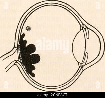 . Die Fundusokuli von Vögeln, vor allem, wie durch das Ophthalmoskop betrachtet; eine Studie in der vergleichenden Anatomie und Physiologie . Abb. 25.amerikanischer Strauß (Rhea americana). Abb. 28.Martineta Tinamou (Calodromas elegans).. Stockfoto