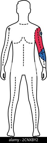 Mann mit künstlicher Hand Farbe Linie Symbol. Person, die eine Prothese anstelle einer echten Hand hat. Piktogramm für Webseite, mobile App, Promo. UI-UX-GUI Stock Vektor