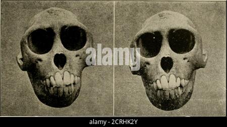 . Elementare und dentale Radiographie / von Howard Riley Raper . J, der Plattenträger wird so lange eingedrückt, bis die nicht belichtete Hälfte der Platte unter das Fenster B fällt und die zweite Belichtung erfolgt. Da die beiden Röntgenaufnahmen in diesem Fall auf der gleichen Platte gemacht werden, sollte besondere Sorgfalt darauf verwendet werden, sie jede dieser Zeitlängen zu belichten. Andernfalls kommen sie ungleich in der Entwicklungslösung auf und es entstehen Röntgenaufnahmen unterschiedlicher Dichte. Wenn die oben skizzierte Technik befolgt wird, wird bei der Beobachtung des fertigen Stereoradiographen festgestellt, dass wir den Teil von der Position der Röhre sehen Stockfoto