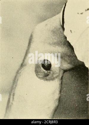. Röntgenstrahlendiagnose und -Therapie . Abb. 311. – Periostal Sarkom des Ex-internal condyle. SONDERANZEIGEN 423. Schwein. 312. – Sarkom des Beins zeigt Gangrän in seiner Mitte. Die Patienten Gattungen] Gesundheit ist gut. (Loleys Erfahrung zeigte Thatin mehrere c asen von inoperableround-celled Sarkom, in denen Histoxin-Behandlung war gestanzt worden und tailed, der Rontgen-Strahl verursacht gesamtes Verschwinden der tu-mours. Doch alle diese Fälle sind von der jüngsten Fall, und in allem hat es eine schnelle Wiederholung. In einer größeren Anzahl seiner Fälle von inoperablem Sarkom verschwanden Thetumoren völlig un-der die Toxine, an Stockfoto