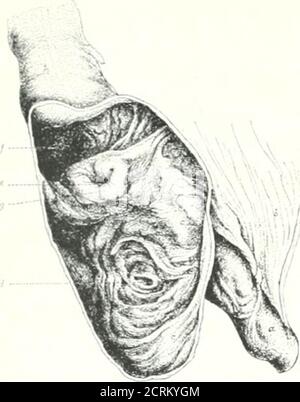 . Archive der Physikalischen Medizin und Rehabilitation . Abb. I Abb.-. 1 – Ileocecal reffion der Ratte.Rig-. 2 – Ileocecal Region von veg-etable-Fütterung Vögel. In der^ronse sind die ceca zusammen doppelt so lang wie der Dünndarm. Abb., 3 – Ileozäkale Region des Pferdes, Rig. 4 – Ileocecal Region des Menschen. Angezeigt werden die oberen und unteren Falten, die sich an der Ileozekaloffnung treffen und Therstinacula bilden. F/G.3 Abb. 4 CC – Zechendarm.ST – Sphinkterischer Trakt.C – Cecum.ill – Ileum. CO – Intercecal Opening.ICO – Ileocecal Opening.AP – Anhang. 413. Wig. 5 – proximaler Dickdarm, gehärtet in situ (Qualn*8 Anatomie). F: Cecalcolon. E – Ileoce Stockfoto