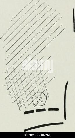 . Die Roentgen Strahlen in der Medizin und Chirurgie als Hilfsmittel in der Diagnose und als therapeutisches Mittel; für den Einsatz von Praktikern und Studenten konzipiert. II, 1898. Körperliche Untersuchung. - Lungen normal, außer dass die Atmung war etwas ruckig an Orten, und der Fremitus leicht über der ganzen rechten Brust erhöht. Rest der körperlichen Untersuchung noch-mal. Diagnose : Phthisis. Mai 13. Am inneren Rand der linken Scapula ein paar Rales; kein Differencein fremitus oder Stimme. Mai 14. Eine gelegentliche unbestimmte Rale hier und da über der Brust, nicht permanent im Charakter; keine Anomalie in der Atmung oder Stimme ; Resonanz Stockfoto