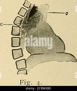 . Der Verdauungstrakt: Eine radiographische Studie. Abb.- 3-. Stockfoto